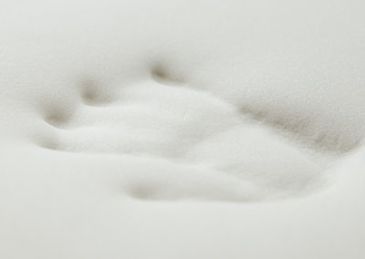 Artikel: Trykaflastende topmadras til børn under bedøvelse